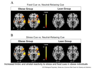 2013 Biological Psychiatry. Stress as a Common Risk Factor for Obesity and Addiction
Increased limbic and striatal reactivity to stress and food cues in obese individuals
 
