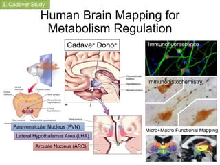 Human Brain Mapping for
Metabolism Regulation
Paraventricular Nucleus (PVN)
Lateral Hypothalamus Area (LHA)
Arcuate Nucleus (ARC)
Cadaver Donor
3. Cadaver Study
Immunofluorescence
Immunohistochemistry
Micro+Macro Functional Mapping
81
 