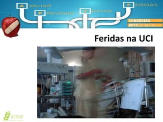 Feridas na UCI
 