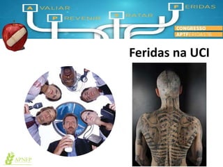 Feridas na UCI
 