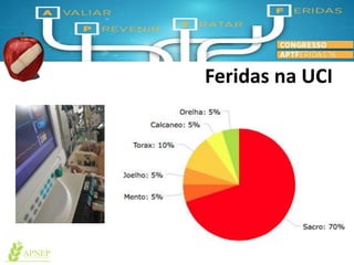 Feridas na UCI
 