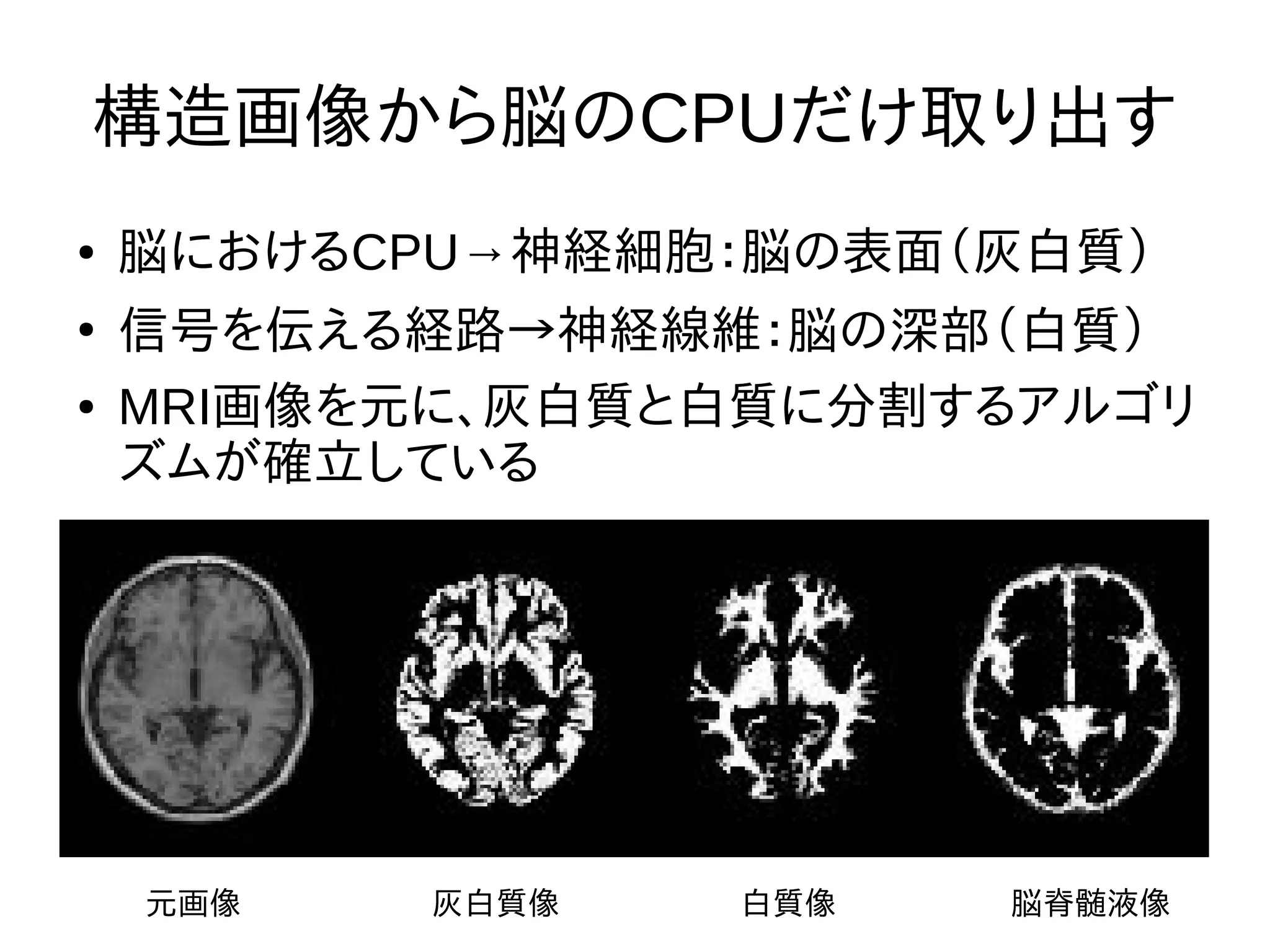 構造画像から脳のCPUだけ取り出す
● 脳におけるCPU→神経細胞：脳の表面（灰白質）
●
信号を伝える経路→神経線維：脳の深部（白質）
● MRI画像を元に、灰白質と白質に分割するアルゴリ
ズムが確立している
元画像 灰白質像 白質像 脳脊髄液像
 