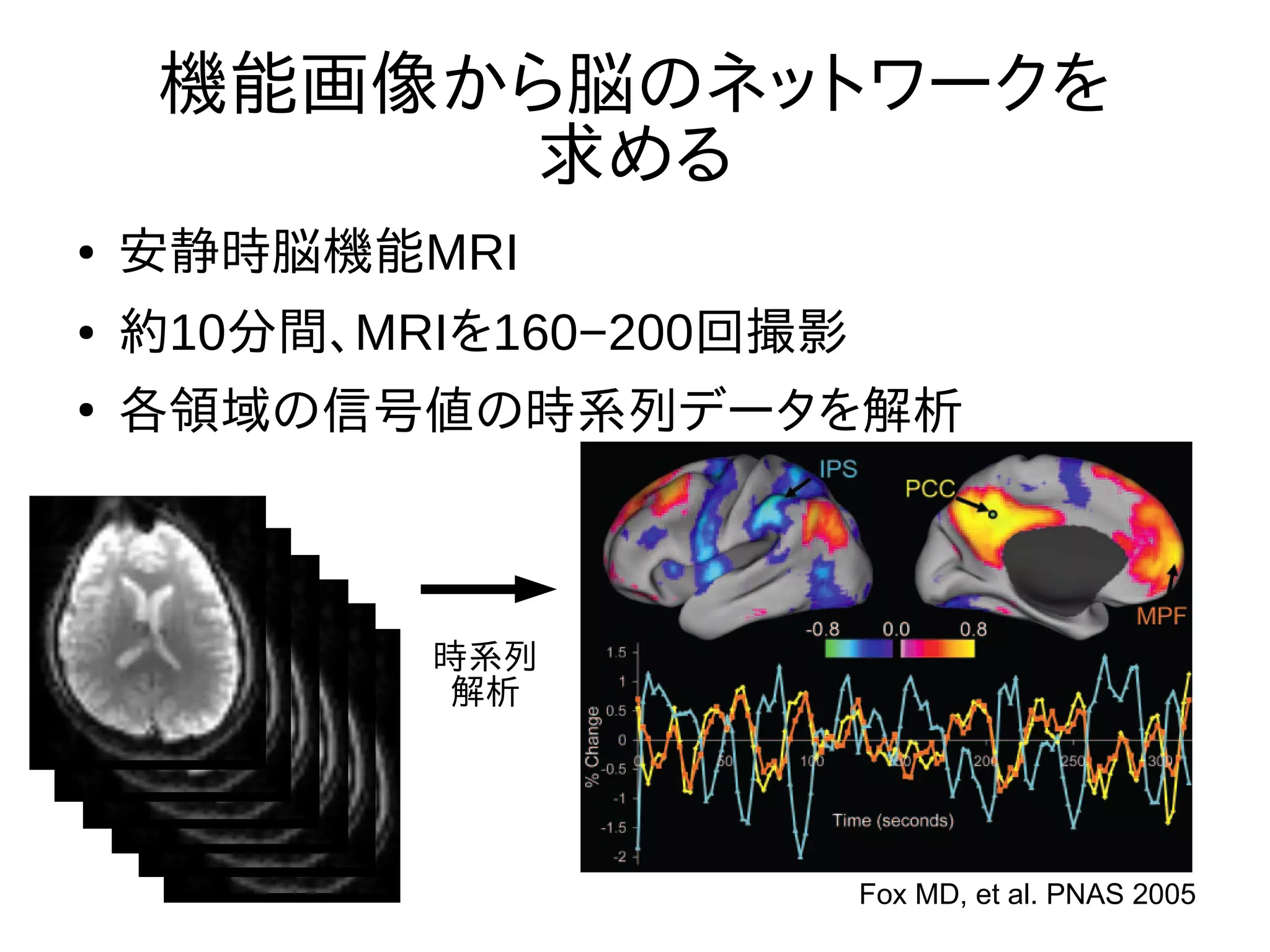 機能画像から脳のネットワークを
求める
● 安静時脳機能MRI
● 約10分間、MRIを160−200回撮影
●
各領域の信号値の時系列データを解析
Fox MD, et al. PNAS 2005
時系列
解析
 