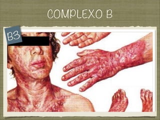 COMPLEXO B
B3
 