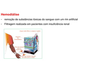 Hemodiálise
- remoção de substâncias tóxicas do sangue com um rim artificial
- Filtragem realizada em pacientes com insuficiência renal
 