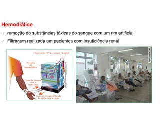 Hemodiálise
- remoção de substâncias tóxicas do sangue com um rim artificial
- Filtragem realizada em pacientes com insuficiência renal
 