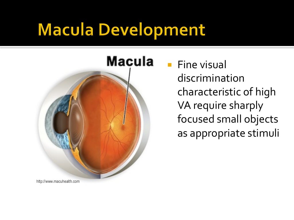 2016 I. Binocular Vision & Retinal Correspondence; II Amblyopia