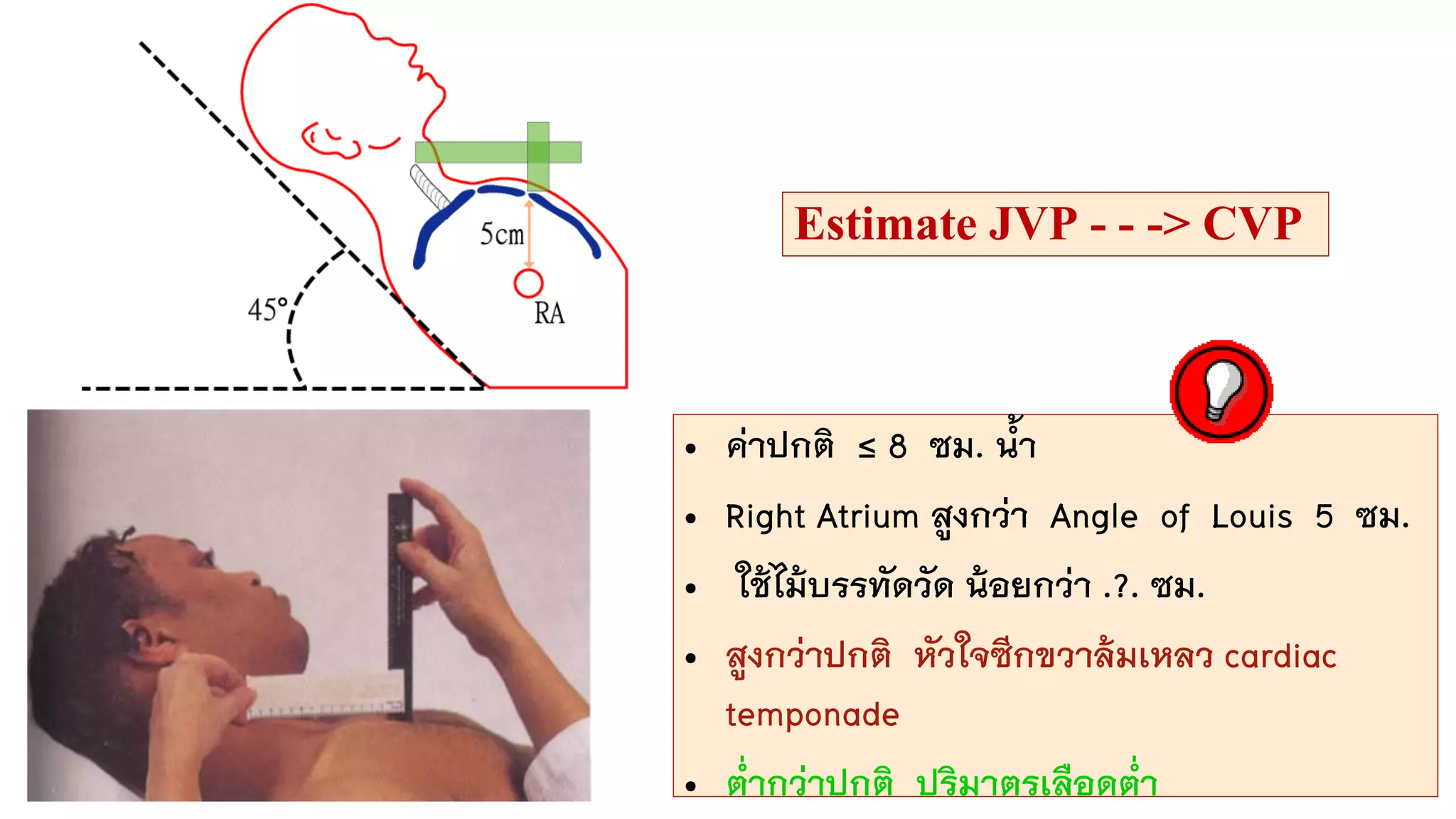 Estimate JVP - - -> CVP
• ค่าปกติ ≤ 8 ซม. น้า
• Right Atrium สูงกว่า Angle of Louis 5 ซม.
• ใช้ไม้บรรทัดวัด น้อยกว่า .?. ซม.
• สูงกว่าปกติ หัวใจซีกขวาล้มเหลว cardiac
temponade
• ต่ากว่าปกติ ปริมาตรเลือดต่า
 