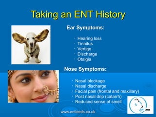 Ent Problems Symtom Practical ENT Problems in General Practise | PPT