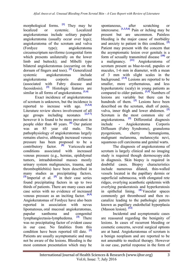Unusual bleeding from scrotal skin angiokeratoma of scrotum