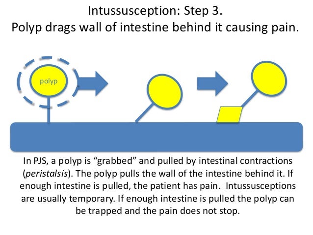 16 May Version C Pearls In The Management Of Pjs