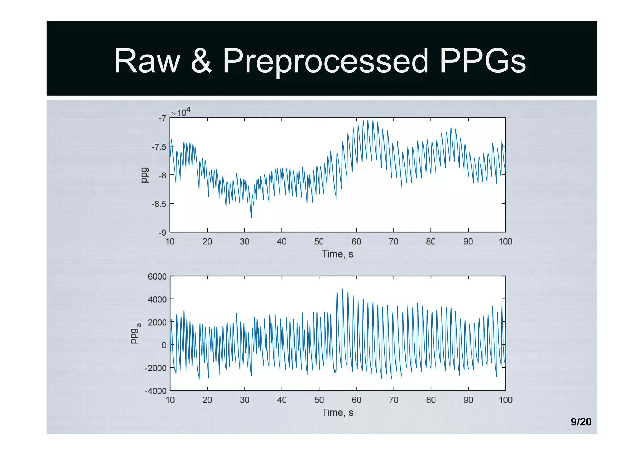 Raw & Preprocessed PPGs
9/20
 
