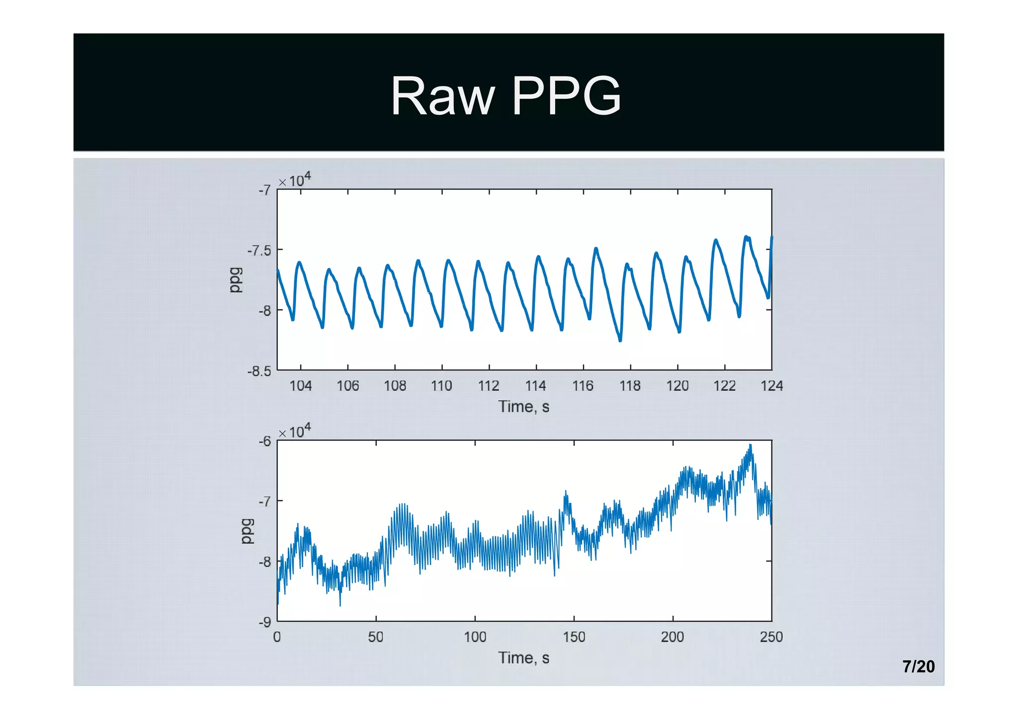 Raw PPG
7/20
 