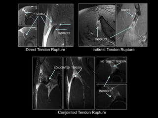 Ramon Balius - Quadriceps Muscle Injuries Diagnosis | PPT