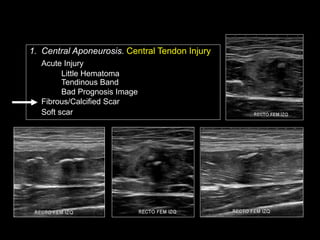 Ramon Balius - Quadriceps Muscle Injuries Diagnosis | PPT