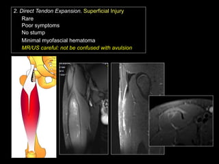 Ramon Balius - Quadriceps Muscle Injuries Diagnosis | PPT