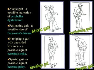 14
Ataxic gait - a
possible indication
of cerebellar
dysfunction.
Festinating gait - a
possible sign of
Parkinson's disease.
Hemiplegic gait
with one-sided
weakness - a
possible sign of
cerebral stroke.
Spastic gait - a
possible sign of
cerebral palsy.
 