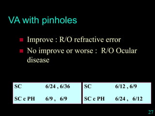 27
VA with pinholes
 Improve : R/O refractive error
 No improve or worse : R/O Ocular
disease
SC 6/24 , 6/36
SC c PH 6/9 , 6/9
SC 6/12 , 6/9
SC c PH 6/24 , 6/12
 