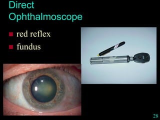 28
Direct
Ophthalmoscope
 red reflex
 fundus
 