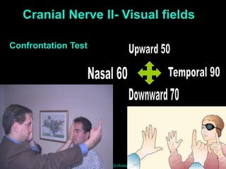 rangsima@chiangmai.ac.th 35
Confrontation Test
Cranial Nerve II- Visual fields
 