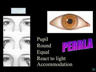 38
Pupil
Pupil
Round
Equal
React to light
Accommodation
 