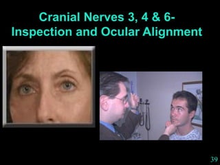 39
Cranial Nerves 3, 4 & 6-
Inspection and Ocular Alignment
 