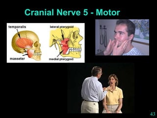 43
Cranial Nerve 5 - Motor
 