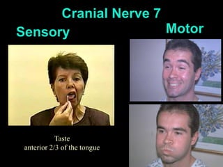 45
Cranial Nerve 7
Taste
anterior 2/3 of the tongue
Sensory Motor
 
