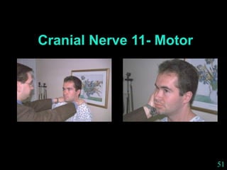51
Cranial Nerve 11- Motor
 
