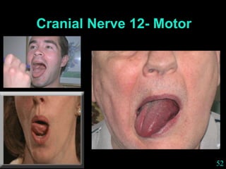 52
Cranial Nerve 12- Motor
 