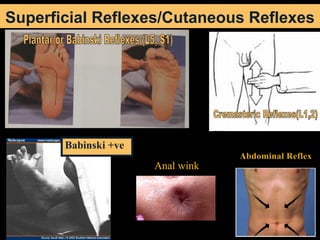 63
Superficial Reflexes/Cutaneous Reflexes
Babinski +ve
Anal wink
Abdominal Reflex
 