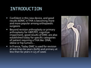 INTRODUCTION
 Confident in this new device, and good
results bDMC inTHA is becoming more
and more popular among orthopaedic
surgeons
 Beyond revision arthroplasty or primary
arthroplasty for HRP,PFF, cognitive
impairment, good results of DMC are also
established today for specific categories
of patient requiring aTHA like ONA,
obese or hip tumors…
 In France,Today DMC is used for revision
at less than 60 years (60%) and primary at
less than 60 years in 1/3 of cases
 