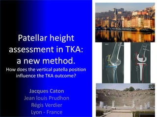Patellar height
assessment in TKA:
a new method.
How does the vertical patella position
influence the TKA outcome?
Jacques Caton
Jean louis Prudhon
Régis Verdier
Lyon - France
 