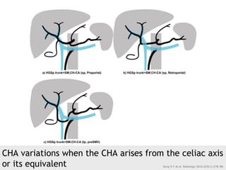 CHA variations when the CHA arises from the celiac axis
or its equivalent Song S-Y et al. Radiology 2010;255(1):278–88.
 