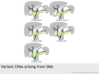 Variant CHAs arising from SMA
Song S-Y et al. Radiology 2010;255(1):278–88.
 