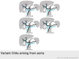 Variant CHAs arising from aorta
Song S-Y et al. Radiology 2010;255(1):278–88.
 