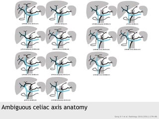 Ambiguous celiac axis anatomy
Song S-Y et al. Radiology 2010;255(1):278–88.
 