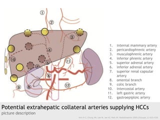 Potential extrahepatic collateral arteries supplying HCCs
picture description
Kim H-C, Chung JW, Lee W, Jae HJ, Park JH. R...