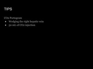 TIPS
CO2 Portogram
● Wedging the right hepatic vein
● 50 mL of CO2 injection
 