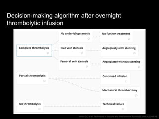 Decision-making algorithm after overnight
thrombolytic infusion
Semba CP, et al. Techniques in Vascular and Interventional...