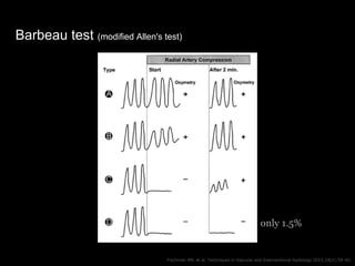 Barbeau test (modified Allen's test)
Fischman AM, et al. Techniques in Vascular and Interventional Radiology 2015;18(2):58...