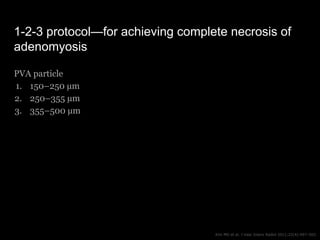 1-2-3 protocol—for achieving complete necrosis of
adenomyosis
PVA particle
1. 150–250 µm
2. 250–355 µm
3. 355–500 µm
Kim M...