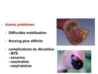 • Autres problèmes
• Difficultés mobilisation
• Nursing plus difficile
• complications du décubitus
- MTE
- escarres
- macération
- respiratoires
 