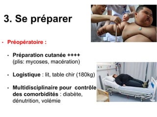 3. Se préparer
• Préopératoire :
• Préparation cutanée ++++
(plis: mycoses, macération)
• Logistique : lit, table chir (180kg)
• Multidisciplinaire pour contrôle
des comorbidités : diabète,
dénutrition, volémie
 