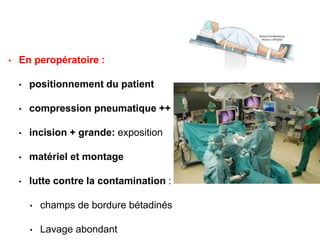 • En peropératoire :
• positionnement du patient
• compression pneumatique ++
• incision + grande: exposition
• matériel et montage
• lutte contre la contamination :
• champs de bordure bétadinés
• Lavage abondant
 