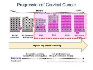 20171021 Personalized Prevention Strategy for Cervical Cancer | PPT