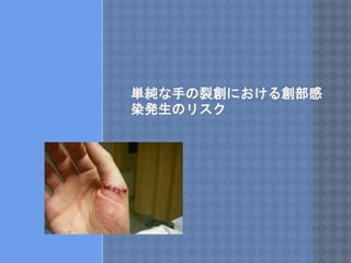 単純な手の裂創における創部感
染発生のリスク
 