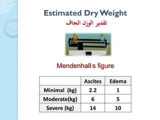 Estimated DryWeight
‫الجاف‬ ‫الوزن‬ ‫تقدير‬
Ascites Edema
Minimal (kg) 2.2 1
Moderate(kg) 6 5
Severe (kg) 14 10
Mendenhall,s figure
 