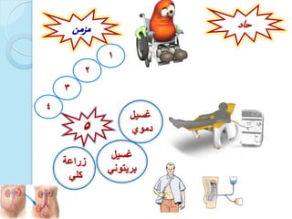 ‫حاد‬
1
2
3
4
‫مزمن‬
‫سراعة‬
‫كلي‬
‫غسيل‬
‫دموي‬
‫غسيل‬
‫بزيتوني‬
 