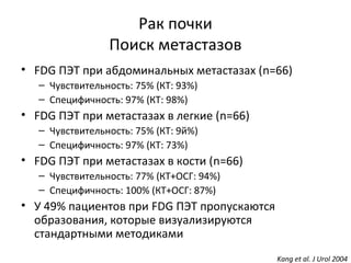 Рак почки
Поиск метастазов
• FDG ПЭТ при абдоминальных метастазах (n=66)
– Чувствительность: 75% (КТ: 93%)
– Специфичность: 97% (КТ: 98%)
• FDG ПЭТ при метастазах в легкие (n=66)
– Чувствительность: 75% (КТ: 9й%)
– Специфичность: 97% (КТ: 73%)
• FDG ПЭТ при метастазах в кости (n=66)
– Чувствительность: 77% (КТ+ОСГ: 94%)
– Специфичность: 100% (КТ+ОСГ: 87%)
• У 49% пациентов при FDG ПЭТ пропускаются
образования, которые визуализируются
стандартными методиками
Kang et al. J Urol 2004
 